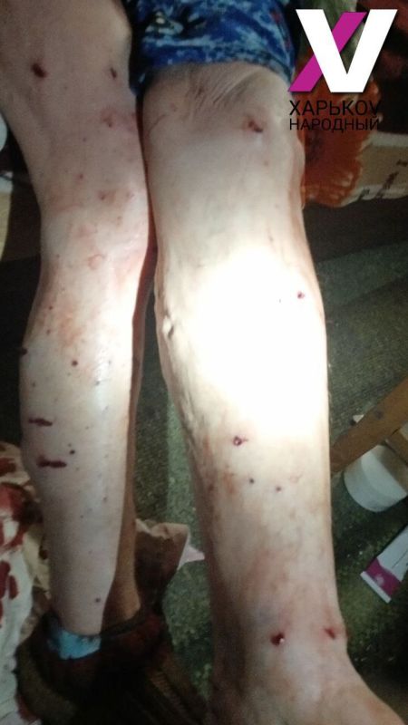 Два жителя села Ольшана Купянского района пострадали от атаки украинского FPV-дрона