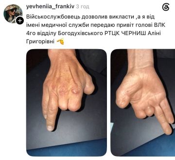 В Богодухове Харьковской области местный ТЦК после врачебной комиссии признал годным мужчину с тремя ампутированными пальцами из пяти на руке